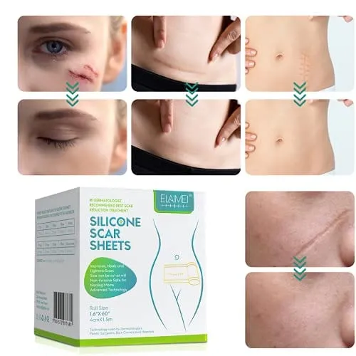 Dermoxy™️ Scar Removal Tape (Pack of 2)