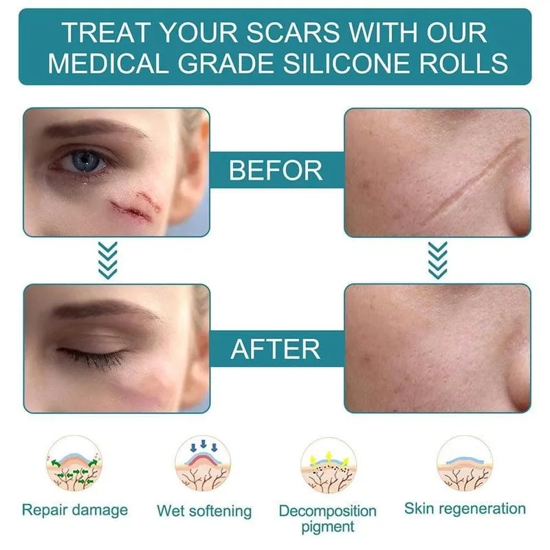 Dermoxy™️ Scar Removal Tape (Pack of 2)
