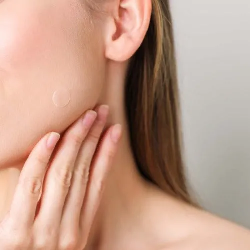 Emergency Dots For Spots and Blemishes